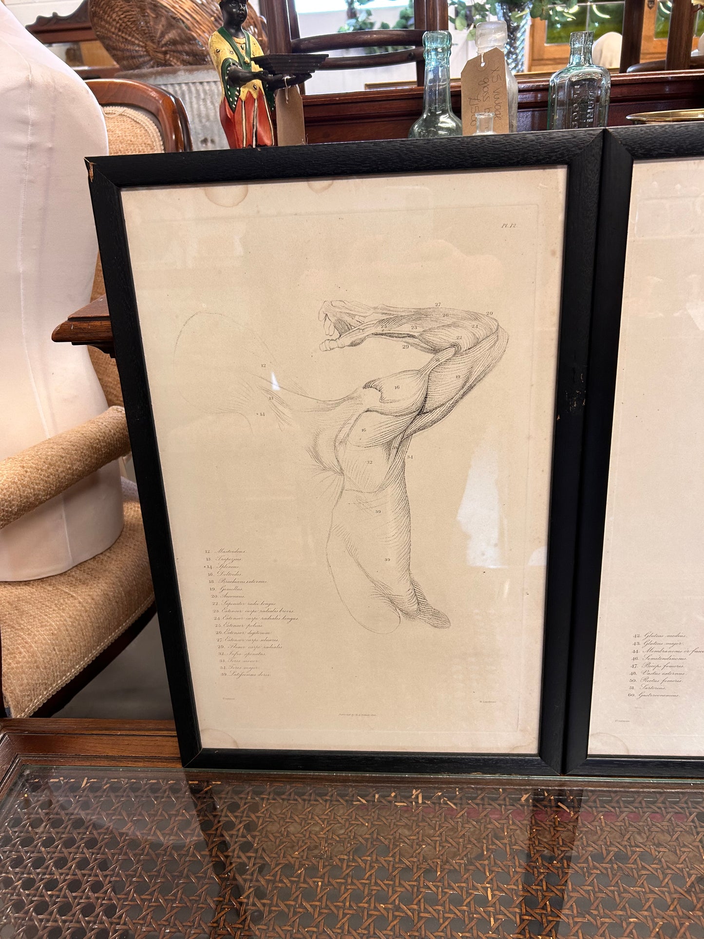 Striking trio vintage Anatomical Lithograph prints framed glazed