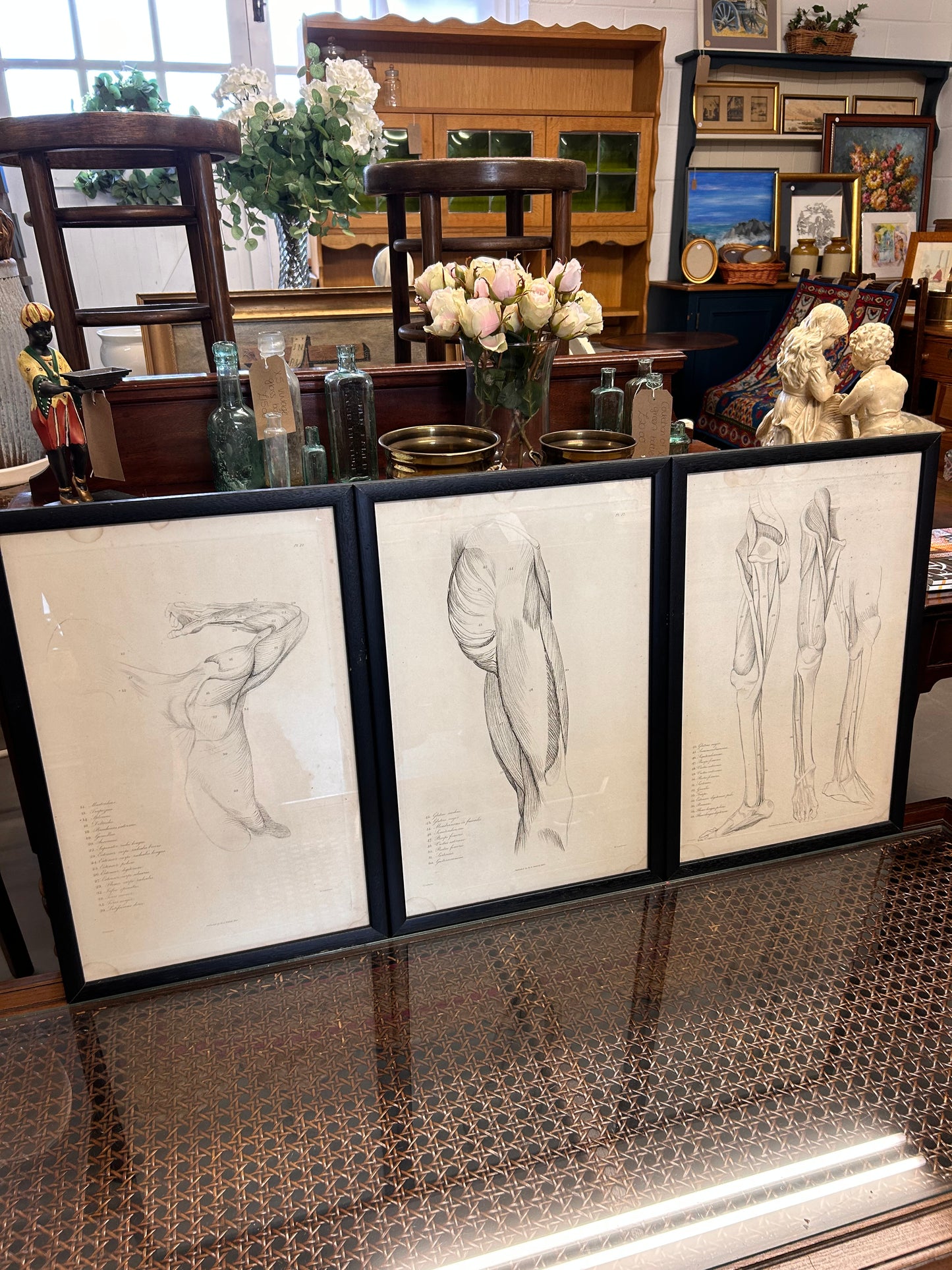 Striking trio vintage Anatomical Lithograph prints framed glazed