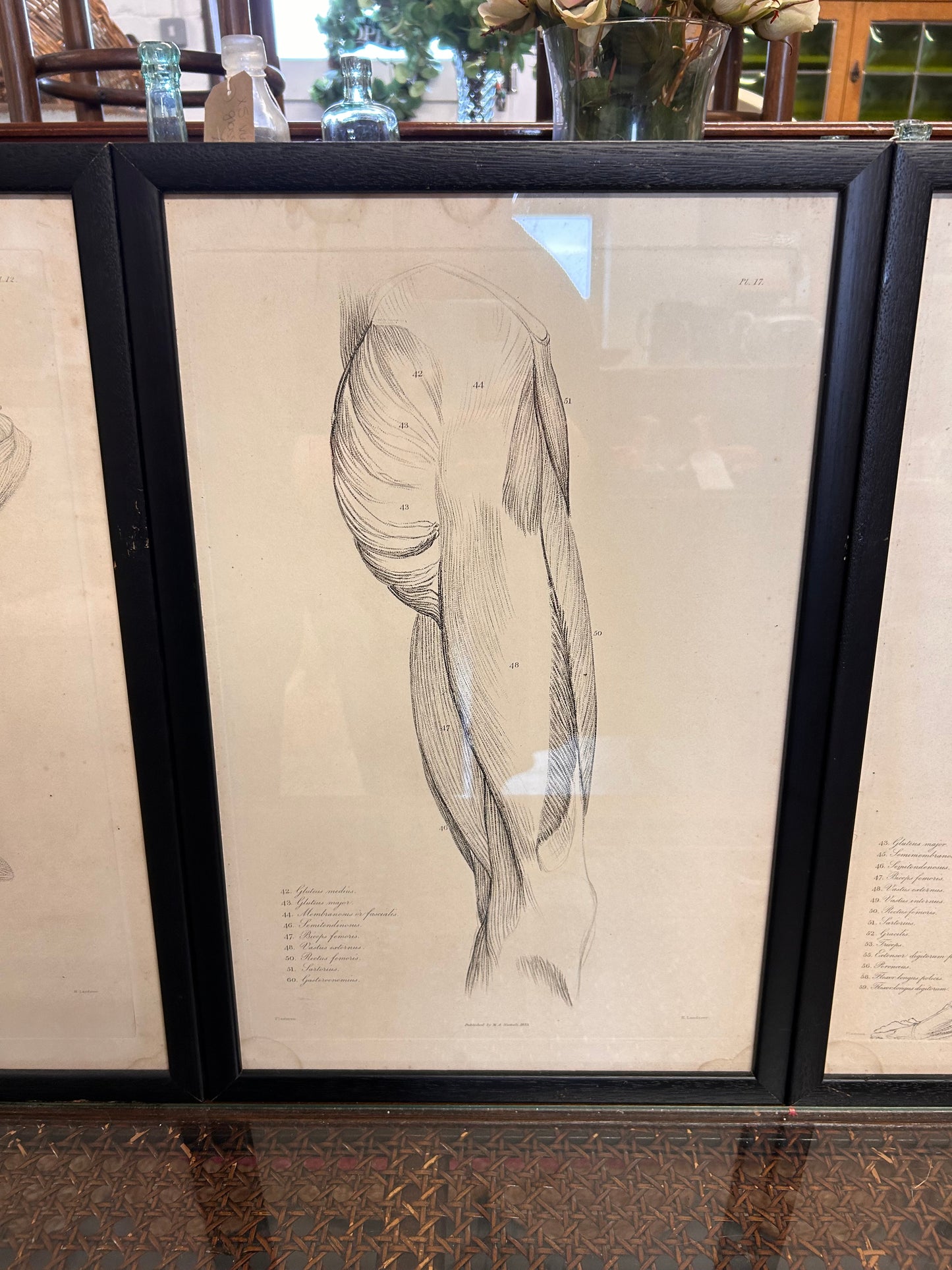 Striking trio vintage Anatomical Lithograph prints framed glazed