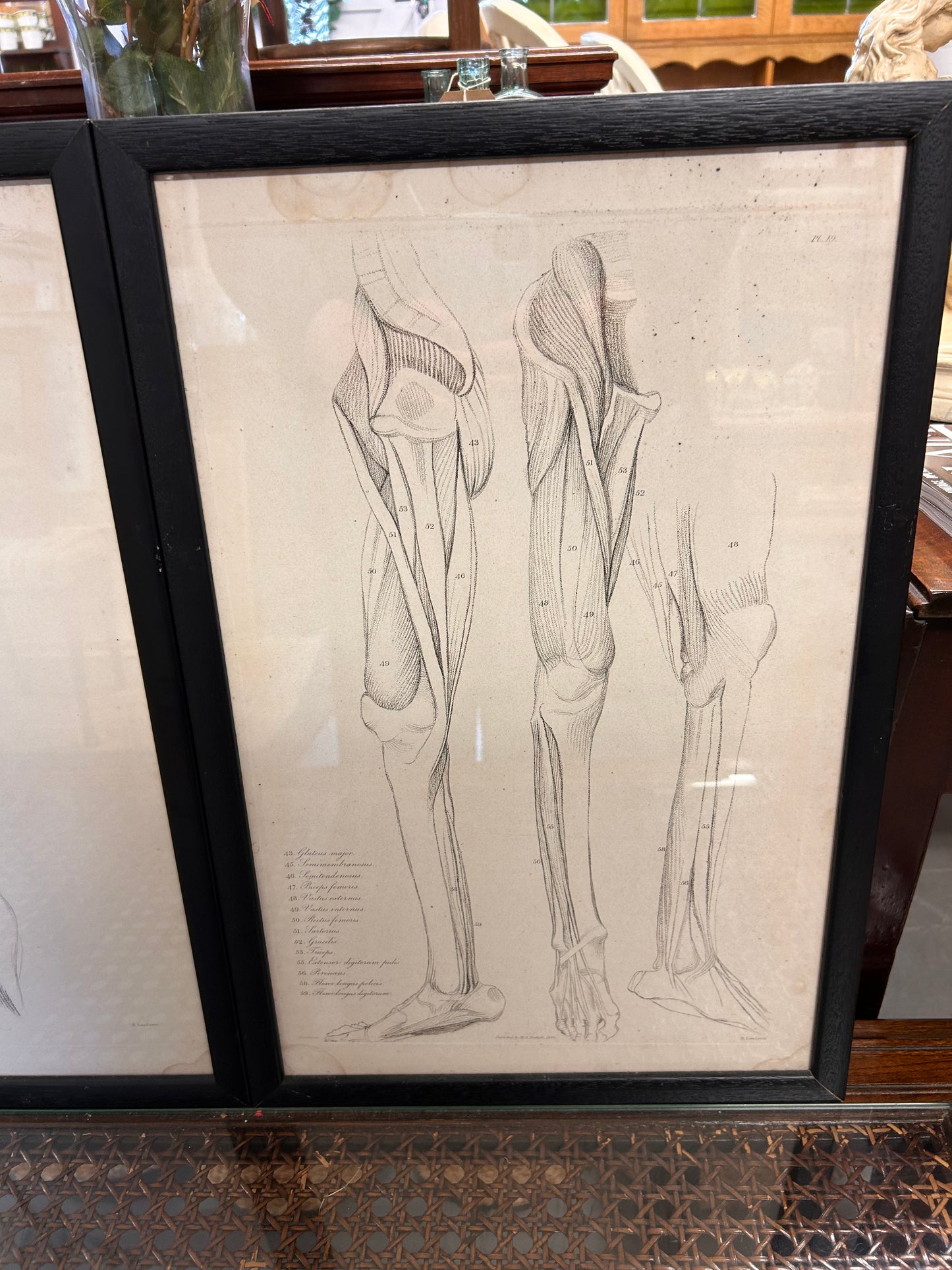 Striking trio vintage Anatomical Lithograph prints framed glazed